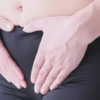 脱毛