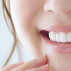 セルフホワイトニング